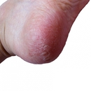 1回でツルすべ！キッチンにある材料を使う簡単フットケア